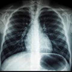 radiologie img