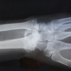 radiologie img