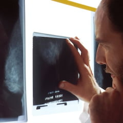 radiologie img