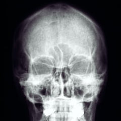 radiologie img